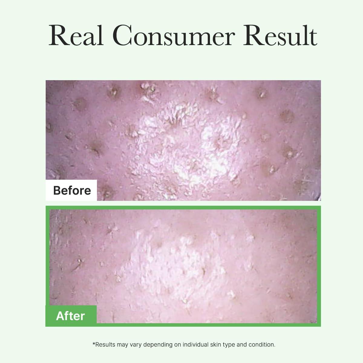 image:imageARENCIA Pore Melt Mochi MakeupRemoving Cleansing Oil NonComedogenic Rice Amino Acids HD Vitamin E Cica amp Ceramide 676 fl oz