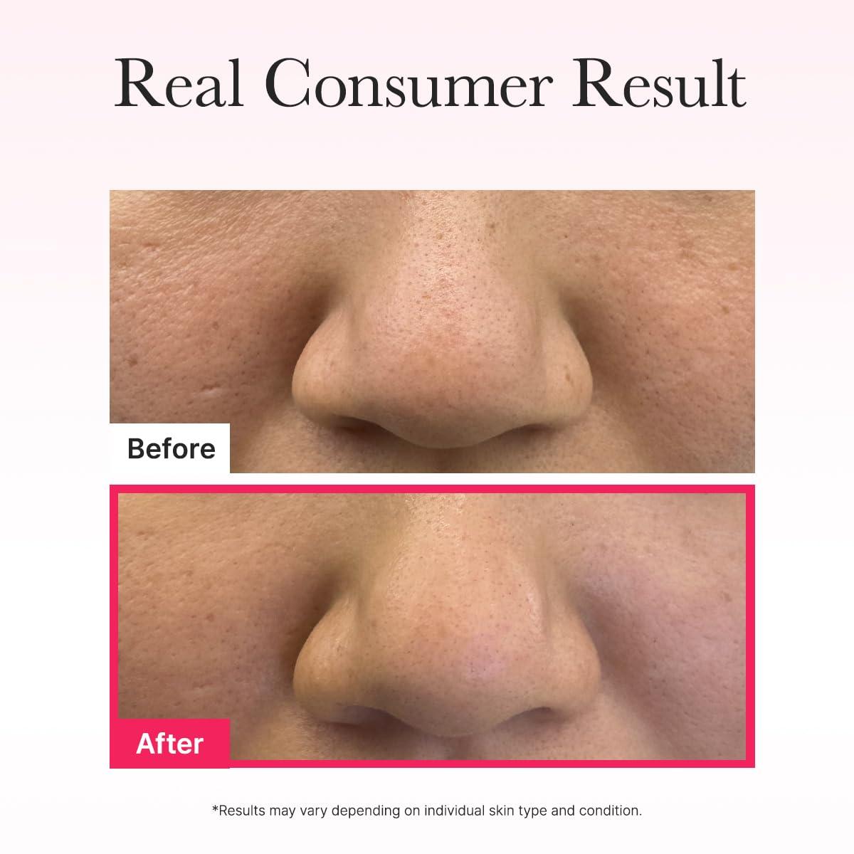 image:imageARENCIA Red Collagen Jello Mask Plump amp Hydrating x 4ea Overnight Hydrogel Mask for Dry Mature Skin Packed with Collagen 5 Peptides 2 Niacinamide