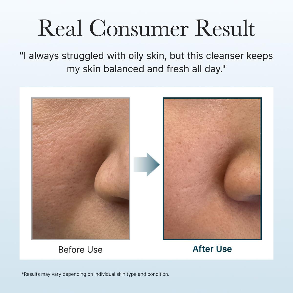 image:imageArencia Rosehip Brightening Rice Mochi Face Cleanser amp Daily Scrub Moisturizing Exfoliating amp DeepCleansing All Skin Types with Rice Powder amp Rice Water 423ozBlue Hyssop